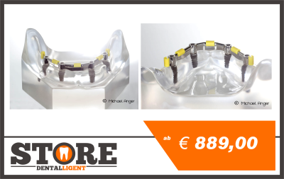 Kategoriebild der Kategorie “Implantate”