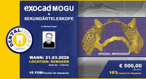 Artikelbild des Artikels “21.03.2026 - EXOCAD Modellguss & Sekundärteleskope - aktiv Workshop “