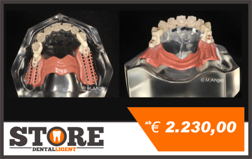 Product image of the product “acrylic model with Zirconium front 14-23, milled Rests and abutments plus wings and secondarys in toothcolored PEEK  and Framework in pink PEEK glued, for self veneering and self completition. ”