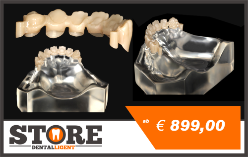 Artikelbild des Artikels “Acryl-Modell mit Zirkon-Front 14-23, gefrästen Lagern und Geschieben zum selbst Verblenden und Fertigstellen. “