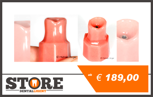 Artikelbild des Artikels “Rosa Einzelstumpfmodell mit Implantat oder Modellimplantat für Präsentationen und Friktionstests. “