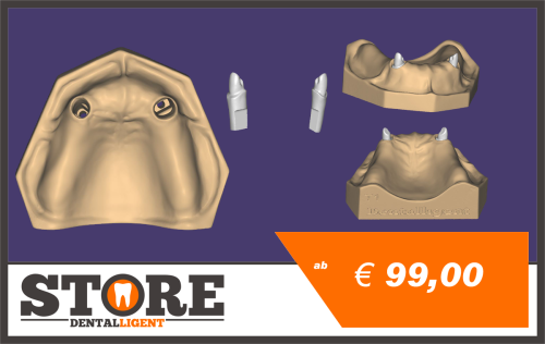 Product image of the product “OK model T1-printed plastic with removable dies. ”