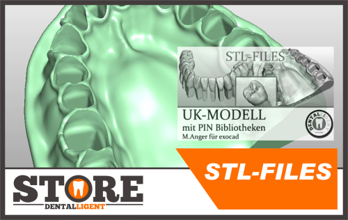 Product image of the product “STL-FILES +  LIBRARY  - Upper jaw-MODELL with PIN- LIBRARY  for exocad by M. Anger ”