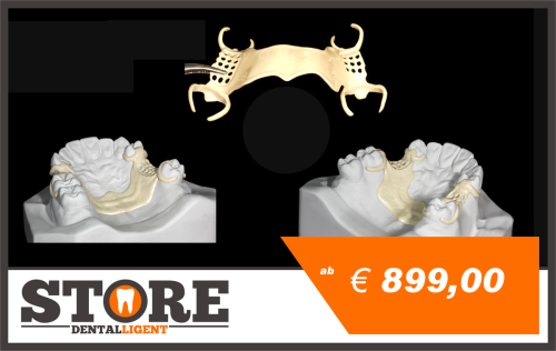 Artikelbild des Artikels “Gipsmodell mit zahnfarbenem PEEK Modellguss und Halteelementen 16,13,24,27 “