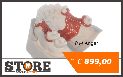 Product image of the product “Plaster model with pink PEEK Partial Framework and clasps at 16,13,24,27 ”