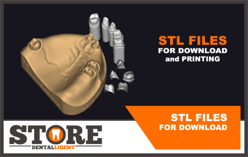 Product image of the product “STL-FILES STL kit training model 5 telescopes to print yourself ”