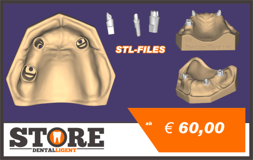 Product image of the product “OK-Model T3-STL-Files for self-print ”