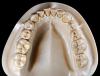 Product image 3 of the product “DEMO Modell S2 - UK -  each 14 teeth removeable. Body and teeth to combine ”