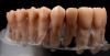 Product image 4 of the product “upper jaw model with root teeth in a clear acrylic base ”