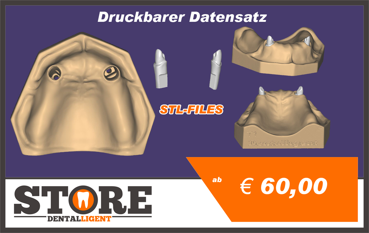 Product image 1 of the product “OK-Model T1-STL-Files for self-print ”