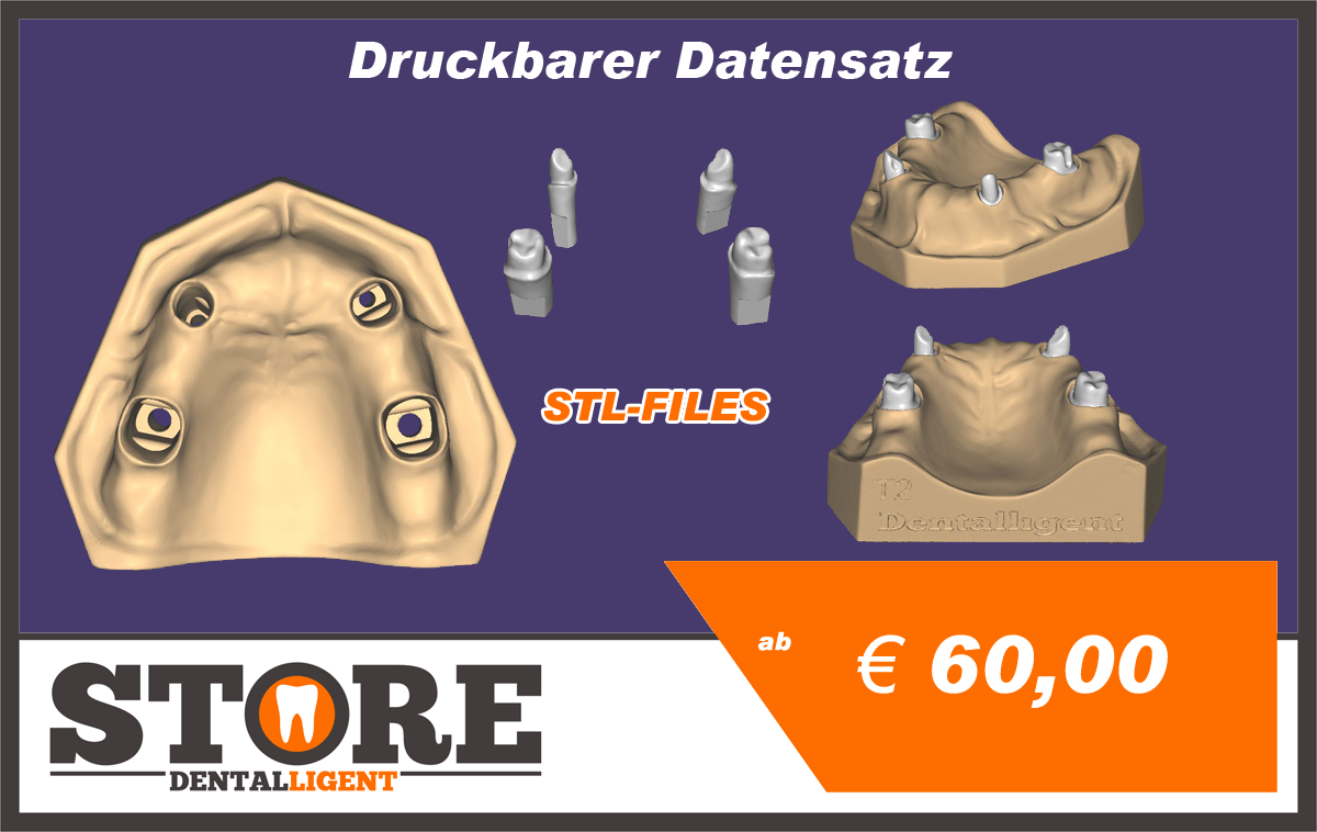 Artikelbild 1 des Artikels “OK-Modell T2-STL-Daten zum selbst drucken “