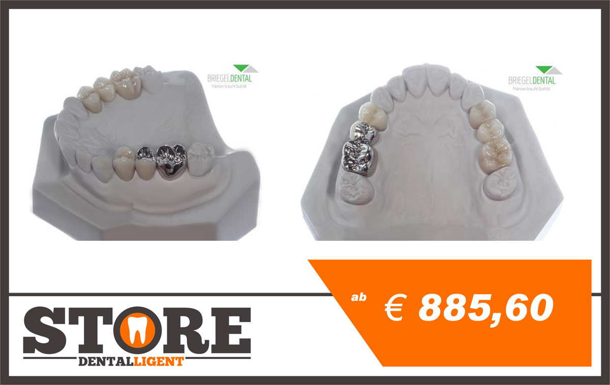 Artikelbild 1 des Artikels “Gipsmodell mit Brücken aus Zirkon und NEM 14-16 & 24-26 keramische Verblendung 4er vollverblendet, 5er vestibulär “