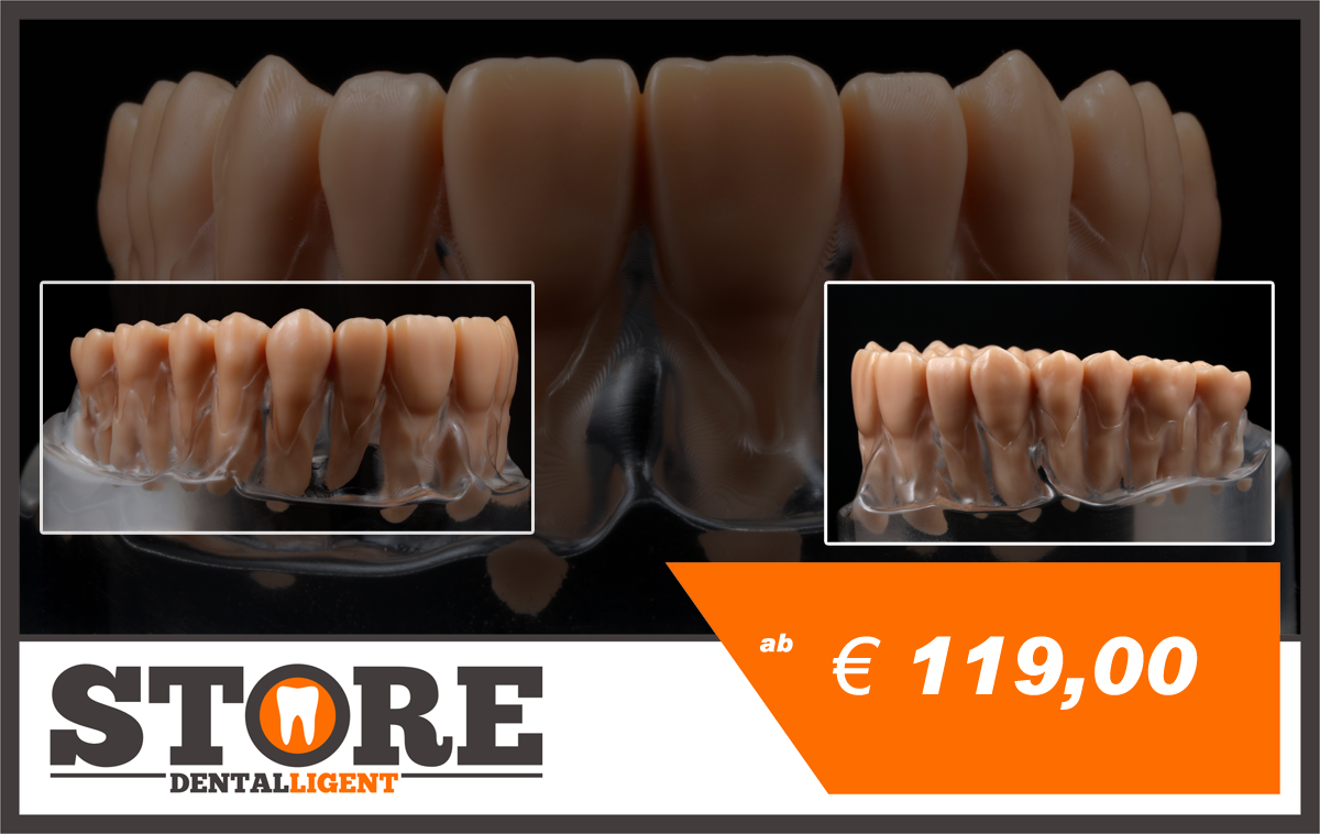 Product image 1 of the product “upper jaw model with root teeth in a clear acrylic base ”