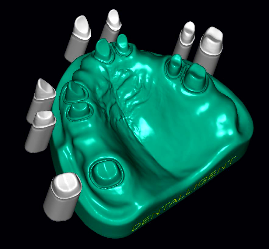 Product image 2 of the product “DEMO OK - Model T6 as STL-FILE to print yourself, with fixed stumps & separate working stumps. ”