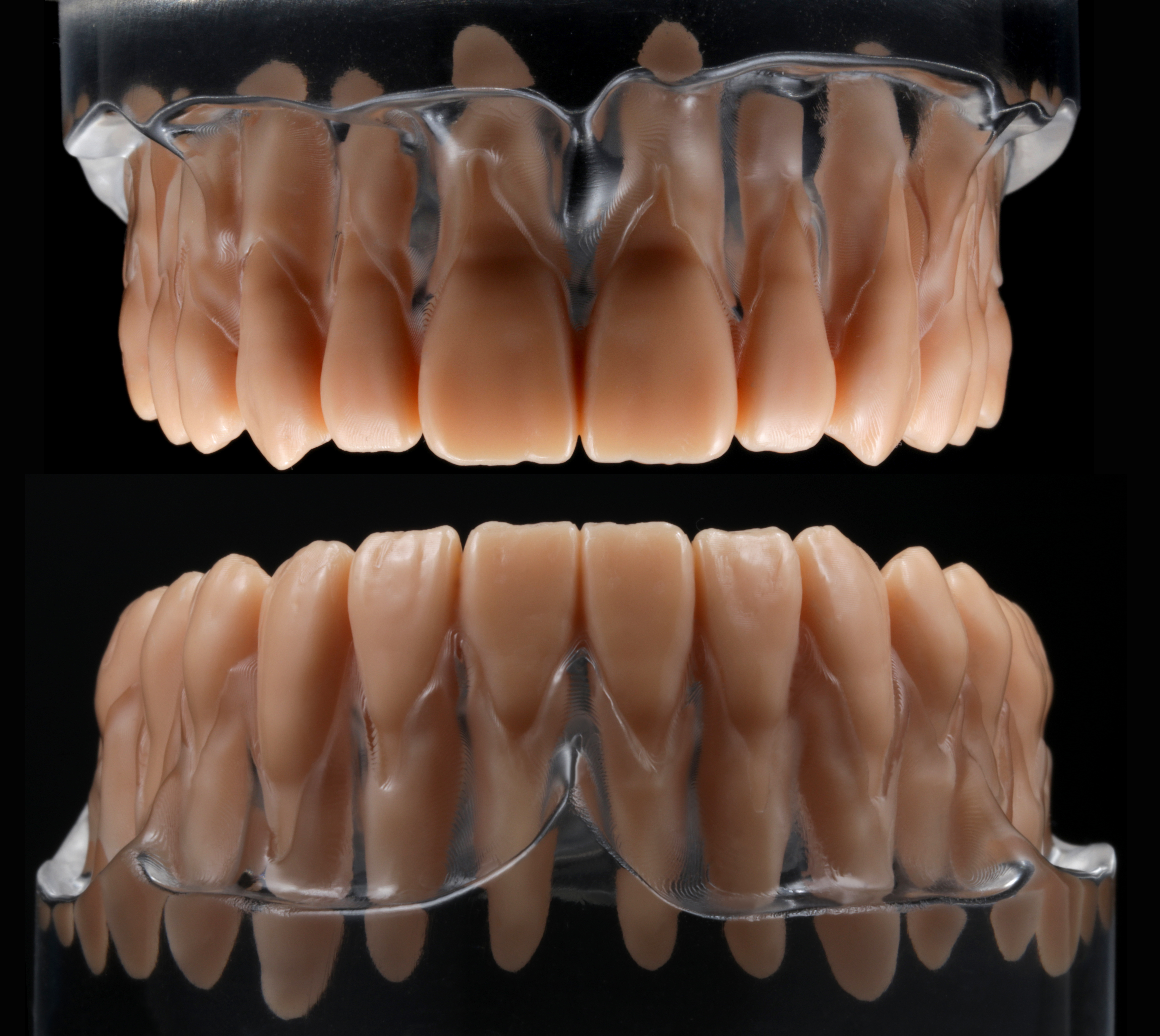 Product image 2 of the product “BUNDLE - lower & upper jaw model with root teeth in a clear acrylic base ”