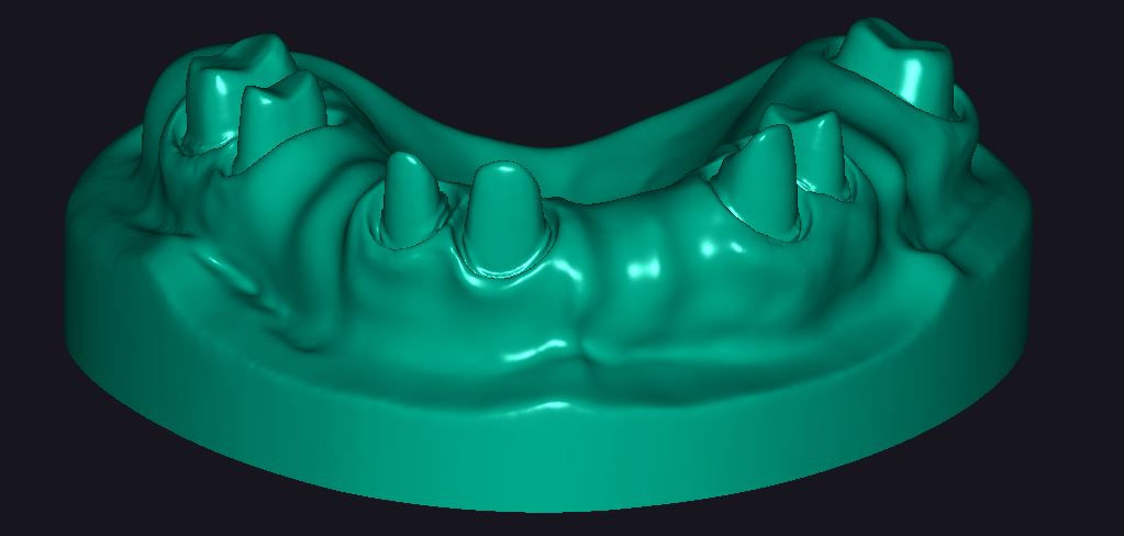 Product image 3 of the product “DEMO OK - Model T6 as STL-FILE to print yourself, with fixed stumps & separate working stumps. ”