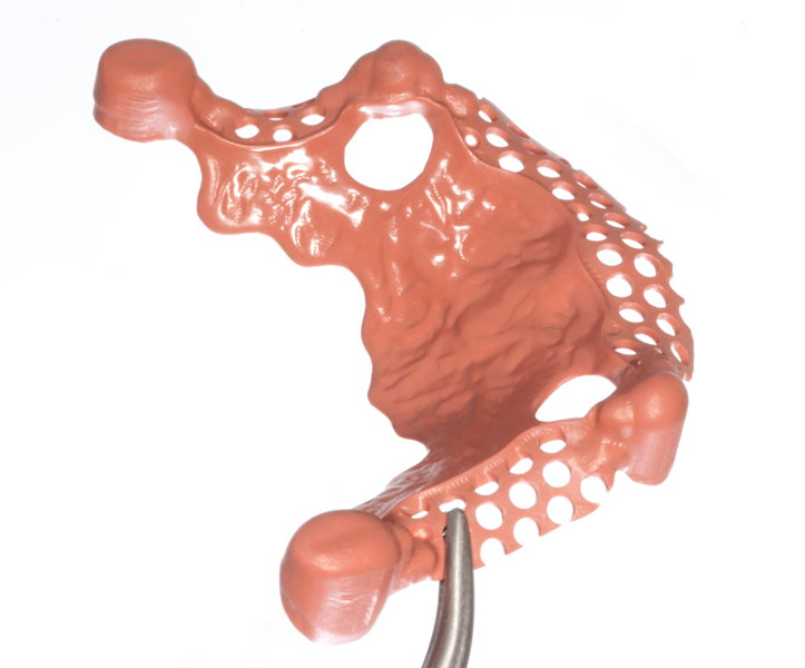 Product image 3 of the product “Model of clear acrylic with pink PEEK secondarys and PEEK framework ”