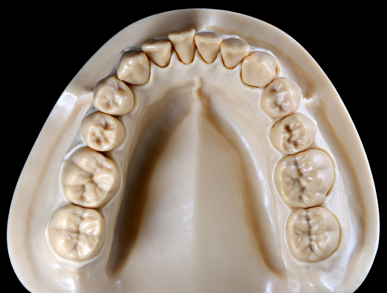 Product image 3 of the product “DEMO Modell S2 - UK -  each 14 teeth removeable. Body and teeth to combine ”
