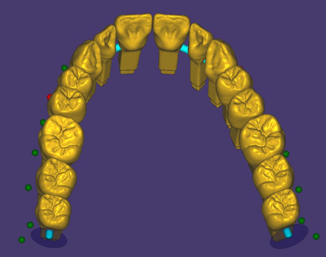 Artikelbild 3 des Artikels “PINS - Vollanatomische Bibliothek nach M. Anger “