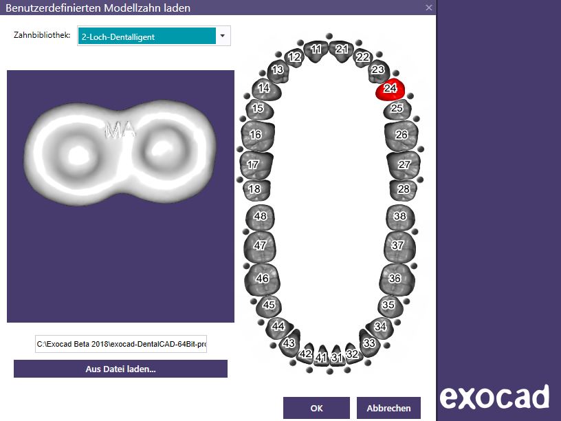 Artikelbild 4 des Artikels “BUNDLE - 1-2-3-4-Loch-Retentionen - nach Michael Anger für die Pontic-Bibliothek für exocad “