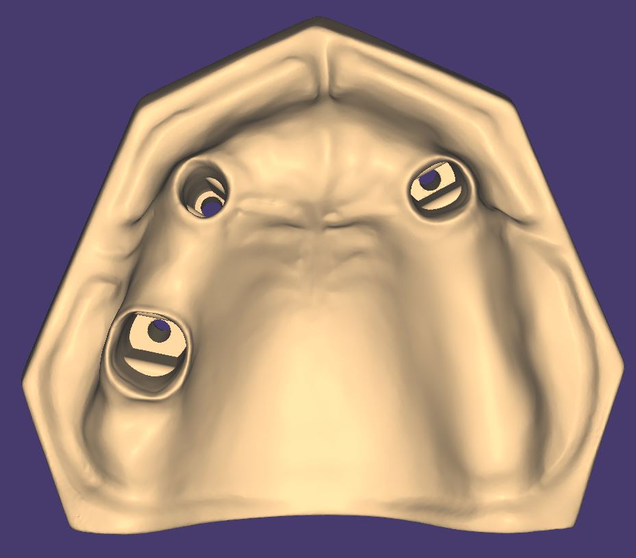 Product image 4 of the product “OK-Model T3-STL-Files for self-print ”