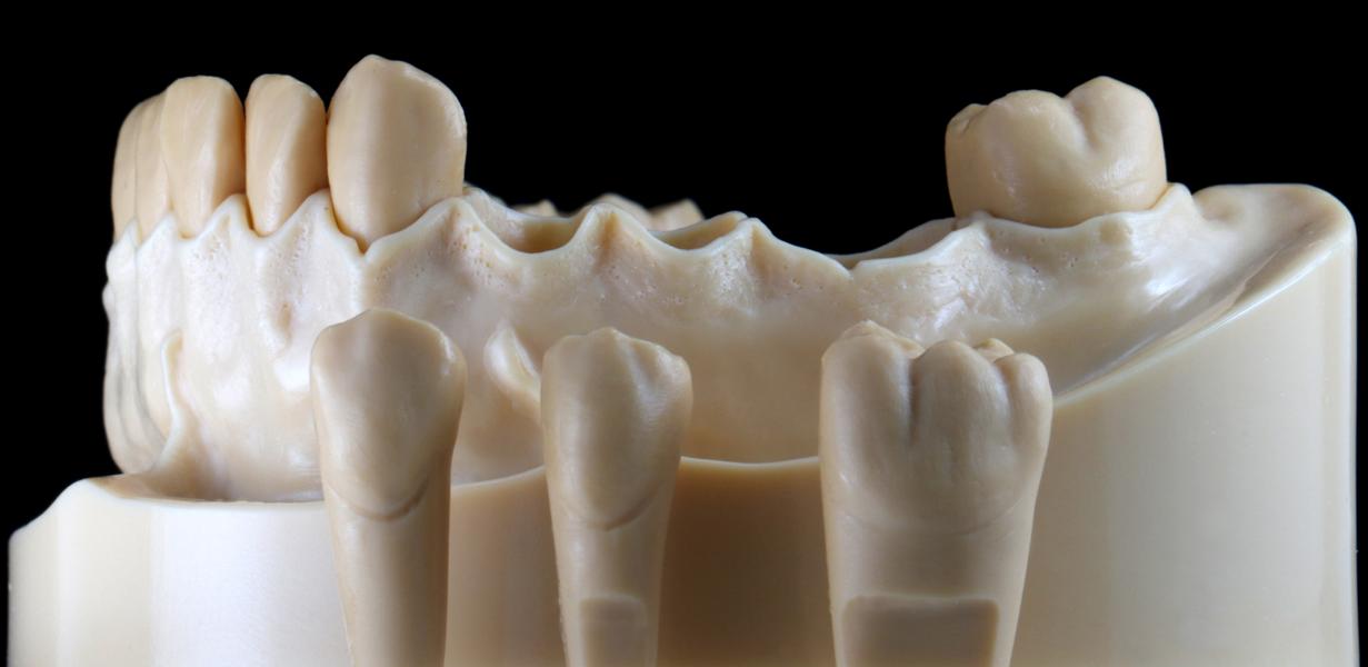 Product image 4 of the product “DEMO Modell S2 - UK -  each 14 teeth removeable. Body and teeth to combine ”