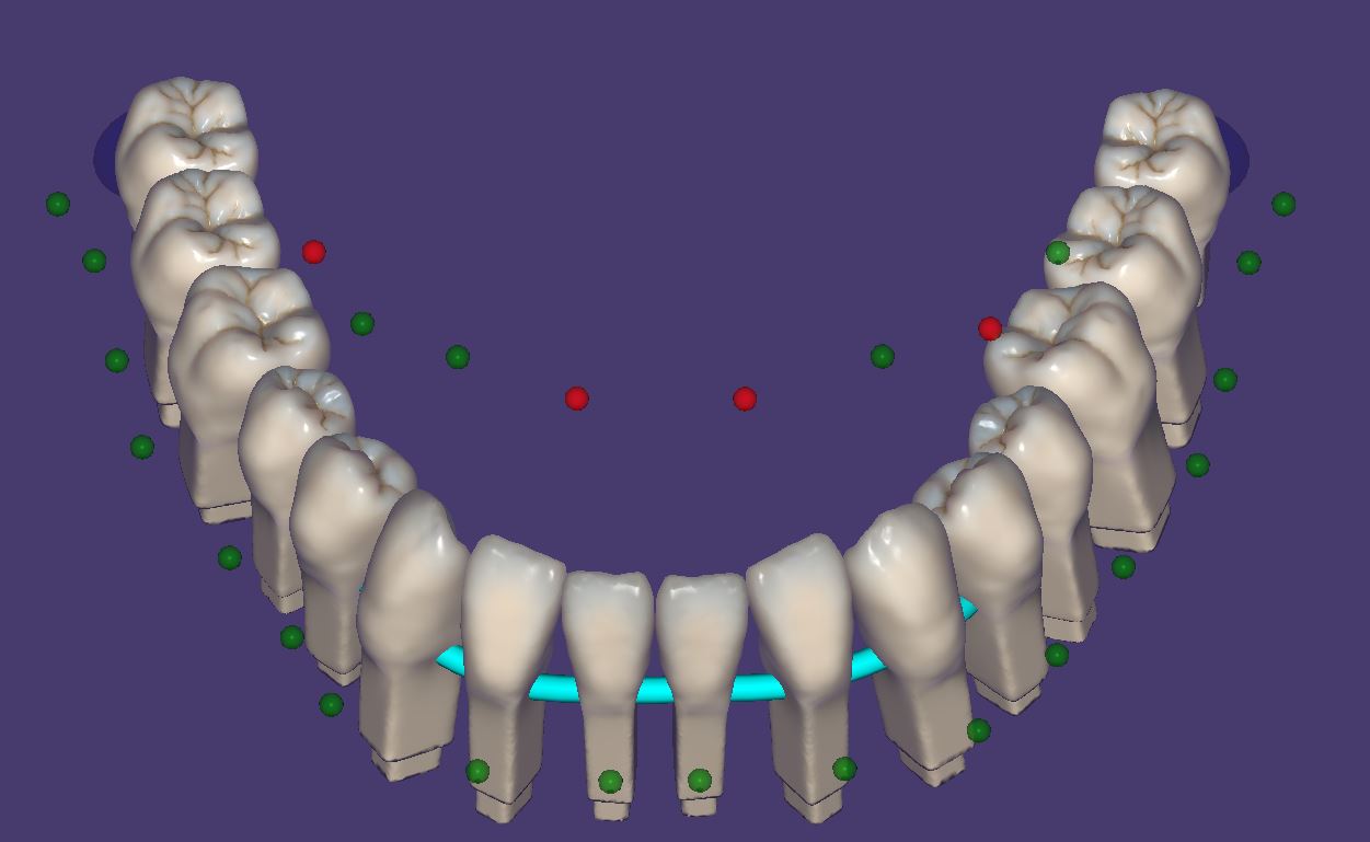Artikelbild 4 des Artikels “PINS - Vollanatomische Bibliothek nach M. Anger “