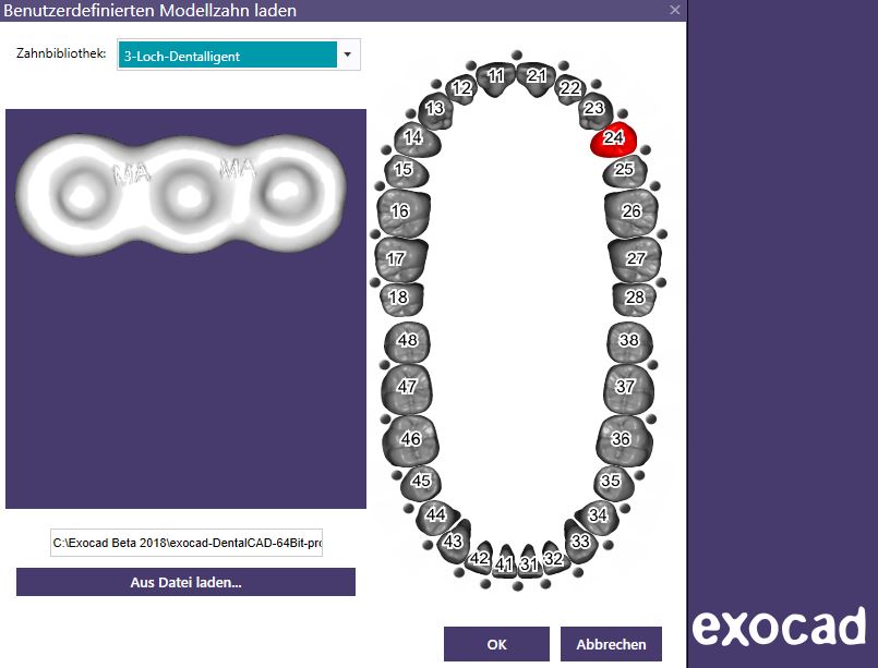 Artikelbild 5 des Artikels “BUNDLE - 1-2-3-4-Loch-Retentionen - nach Michael Anger für die Pontic-Bibliothek für exocad “