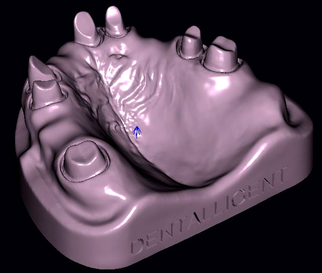 Product image 5 of the product “DEMO OK - Model T6 as STL-FILE to print yourself, with fixed stumps & separate working stumps. ”