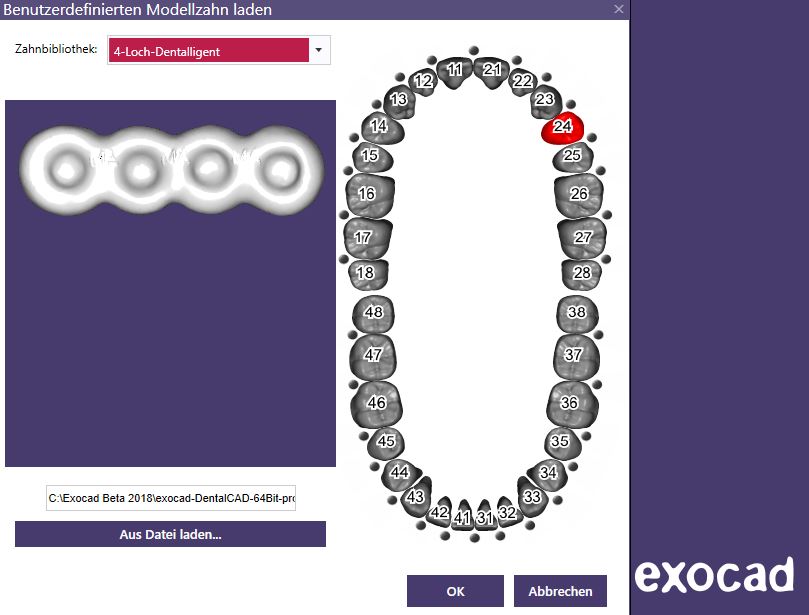 Artikelbild 6 des Artikels “BUNDLE - 1-2-3-4-Loch-Retentionen - nach Michael Anger für die Pontic-Bibliothek für exocad “