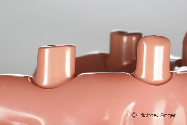 Product image 6 of the product “Upper Jaw with 4 Implants and 4 abutments in Pink PEEK ”